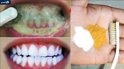 تبييض الأسنان وإزالة الجير بمكونات متوفرة في