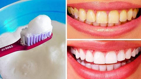 وصفة طبيعية لتبييض الأسنان من الاصفرار والبقع